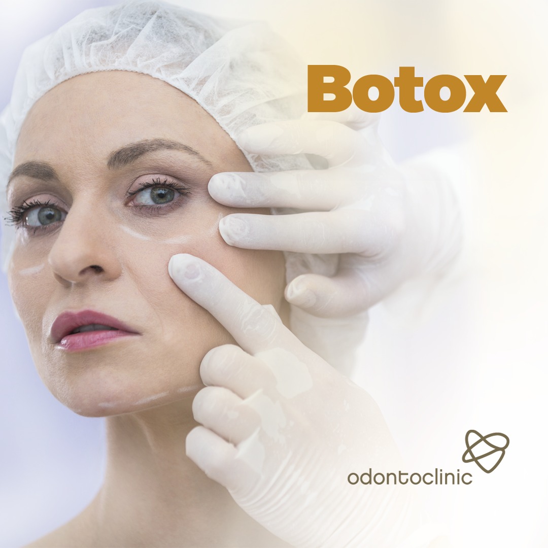 Imagem Botox