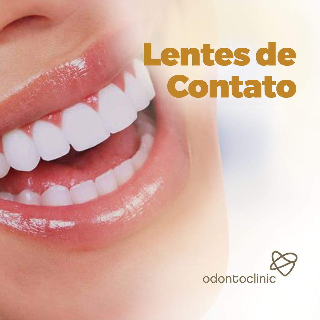 Imagem Lentes de Contato